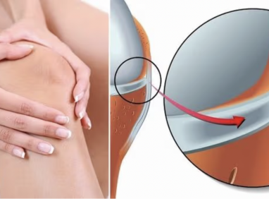 Các bệnh lý về dây chằng thường gặp